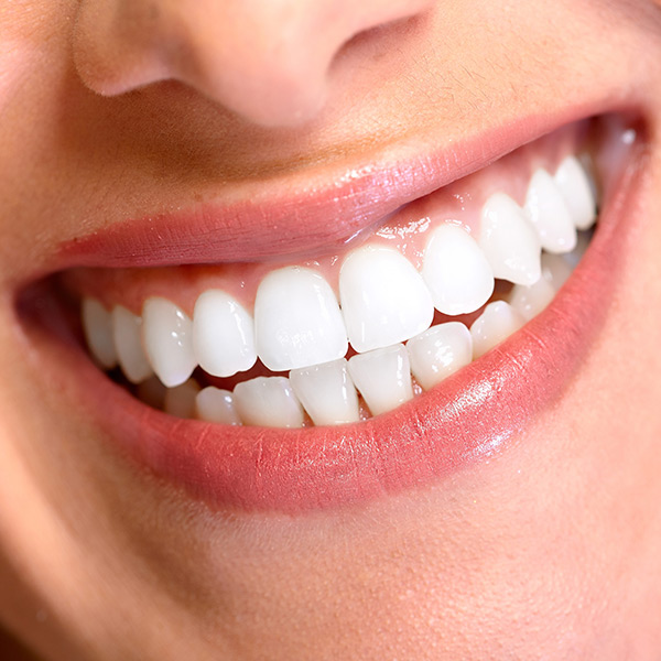 Laser Gum Contouring - Thornhill, Vaughan, Richmond Hill Dentist
