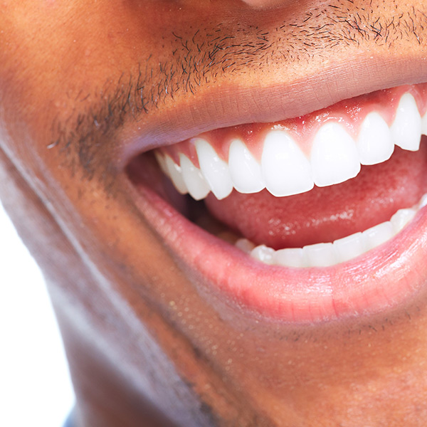 A photo of a smile with healthy gums