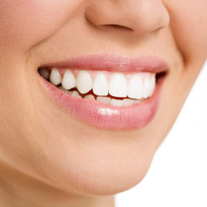 کدام روش برای سفید کردن دندان بهتر است؟|بلیچینگ,خمیر دندان,راه خانگی